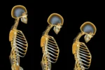 Osteoporosis - Developing Factors and Mitigation with Iron Health